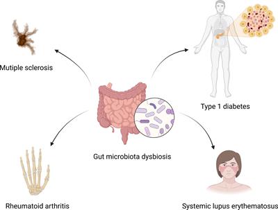 Gut microbiota: a newly identified environmental factor in systemic lupus erythematosus